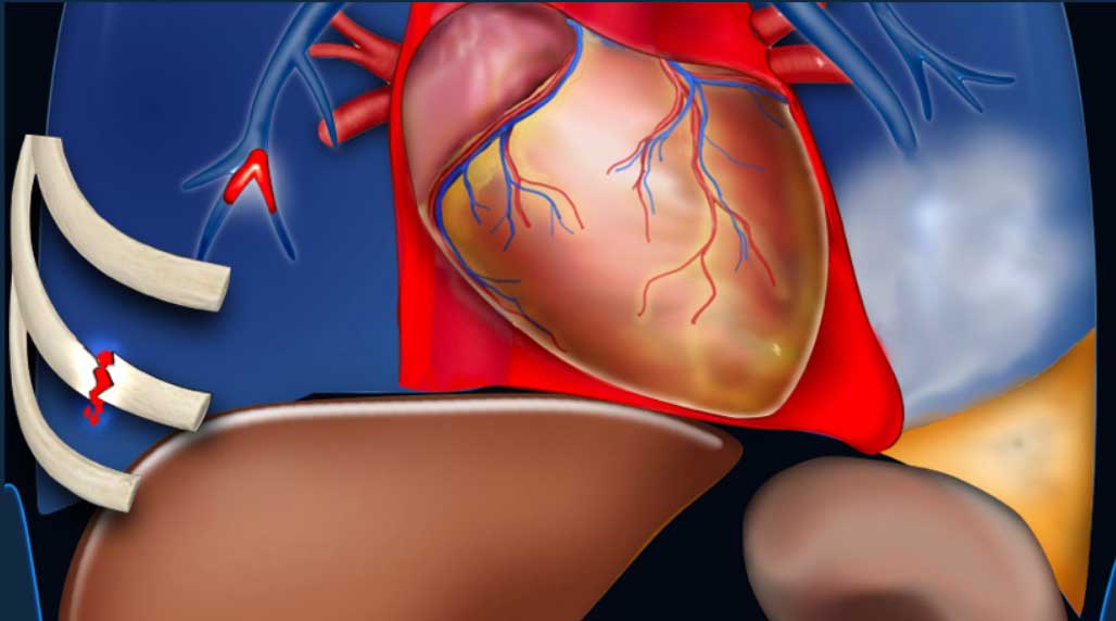 Ultrassonografia torácica e abdome